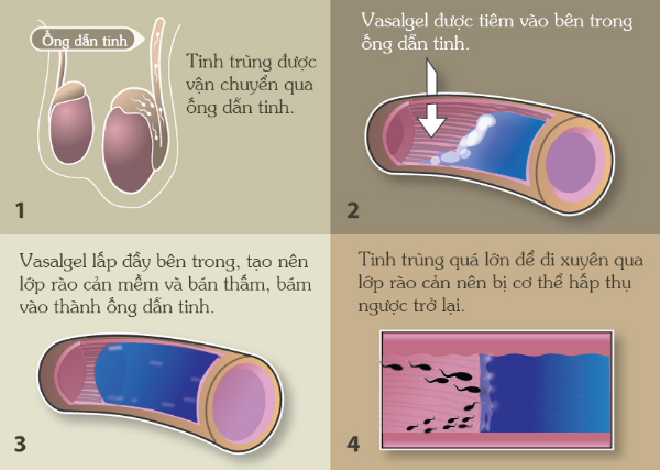 Loại thuốc giúp đàn ông tránh thai trong 2 năm